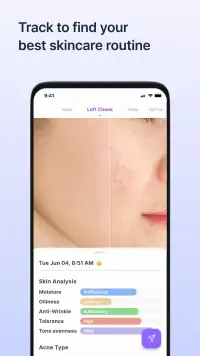 SkinLog | Acne diary screenshot 8