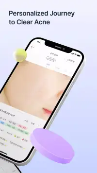SkinLog | Acne diary screenshot 2